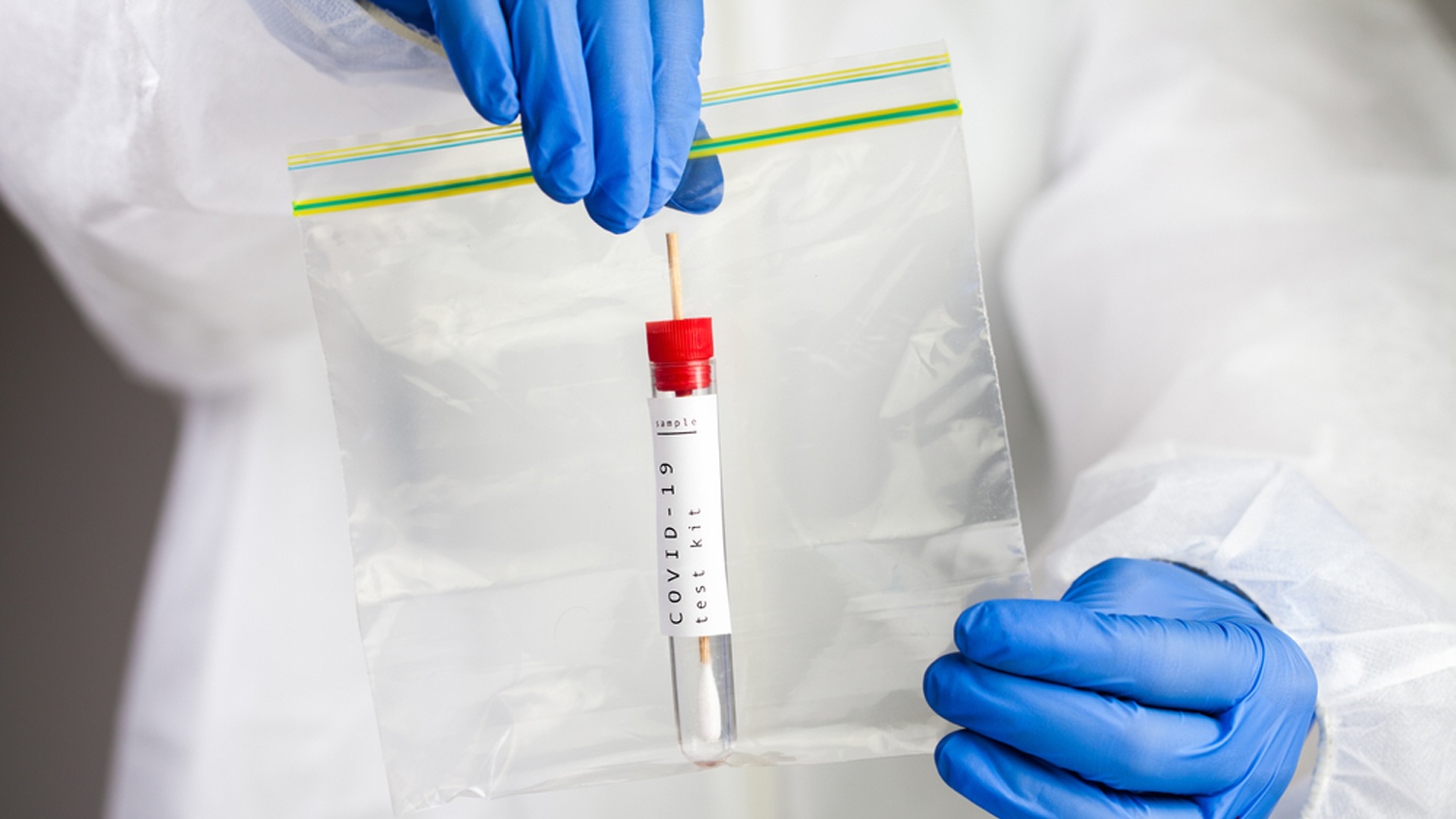 PCR测试从样本中检测病毒的具体水平目前还存在局限性